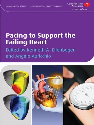 cover image of Pacing to Support the Failing Heart